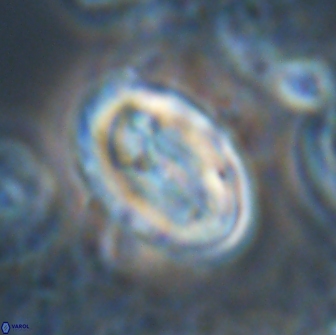 Neocrepidolithus opertus 22268