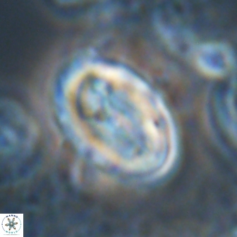 Neocrepidolithus opertus 22268