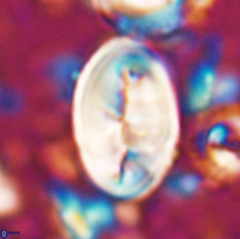 Neocrepidolithus opertus 26125