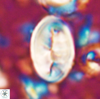 Neocrepidolithus opertus 26125