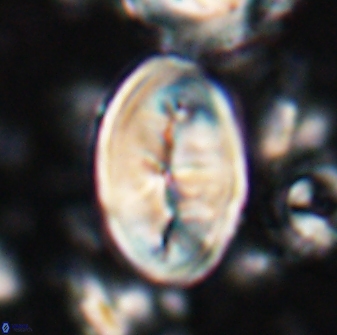 Neocrepidolithus opertus 26126