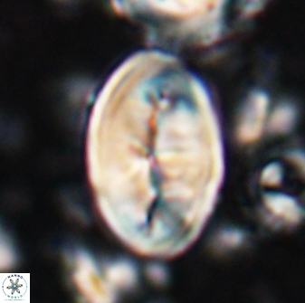 Neocrepidolithus opertus 26126