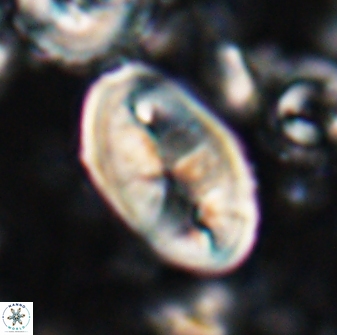 Neocrepidolithus opertus 26127