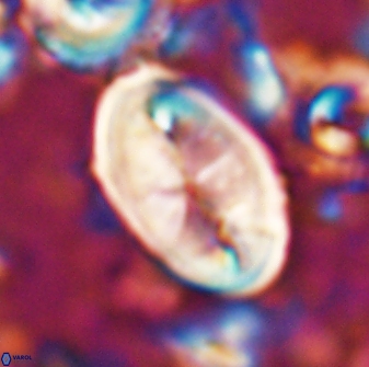 Neocrepidolithus opertus 26128