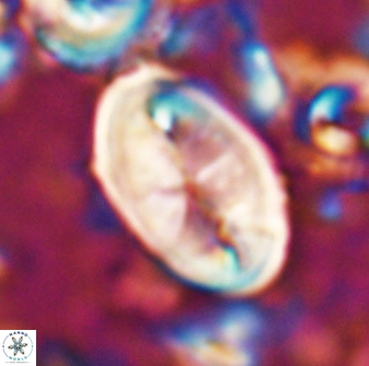 Neocrepidolithus opertus 26128