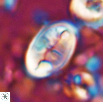 Neocrepidolithus opertus 26129