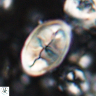 Neocrepidolithus opertus 26130