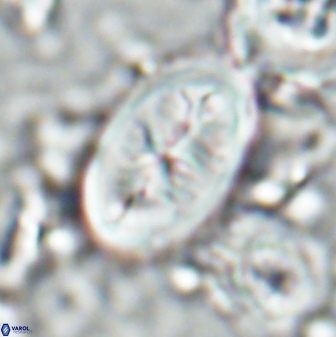 Neocrepidolithus opertus 26131