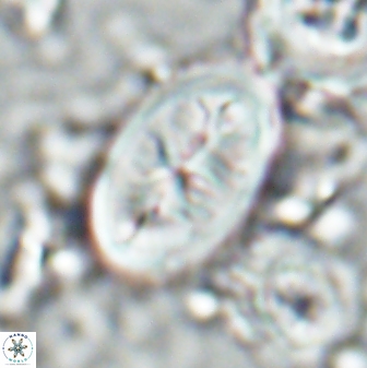 Neocrepidolithus opertus 26131