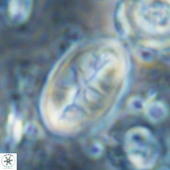 Neocrepidolithus opertus 26132