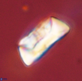 Neocrepidolithus opertus 45274
