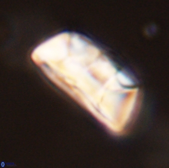 Neocrepidolithus opertus 45276