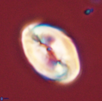 Neocrepidolithus opertus 45278