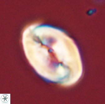 Neocrepidolithus opertus 45278