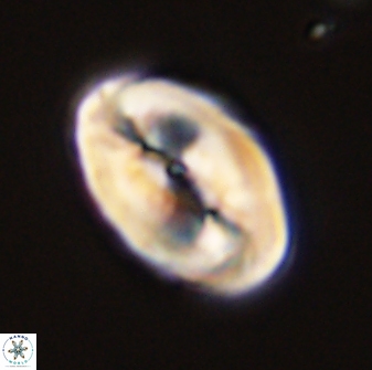 Neocrepidolithus opertus 45279