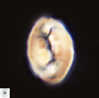 Neocrepidolithus opertus 45280