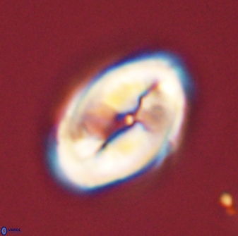 Neocrepidolithus opertus 45282