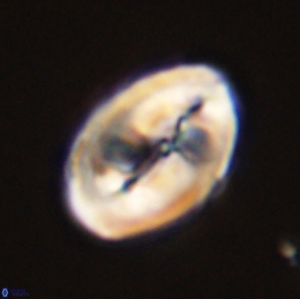 Neocrepidolithus opertus 45284