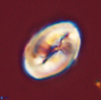 Neocrepidolithus opertus 45285