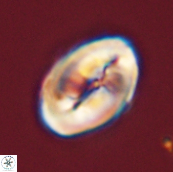 Neocrepidolithus opertus 45285