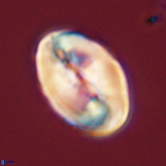 Neocrepidolithus opertus 45286