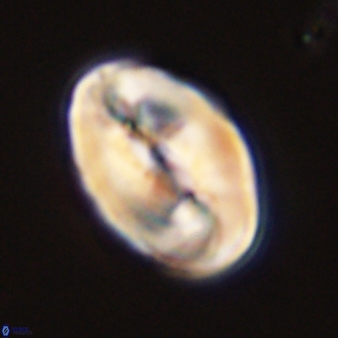 Neocrepidolithus opertus 45287