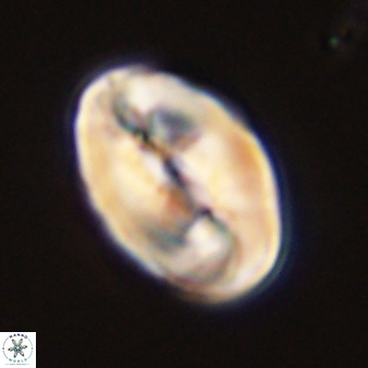 Neocrepidolithus opertus 45287