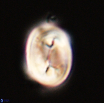 Neocrepidolithus opertus 56851