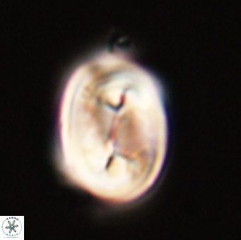 Neocrepidolithus opertus 56851
