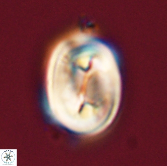 Neocrepidolithus opertus 56852