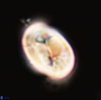 Neocrepidolithus opertus 56854