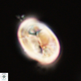 Neocrepidolithus opertus 56854