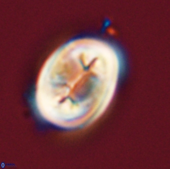 Neocrepidolithus opertus 56856