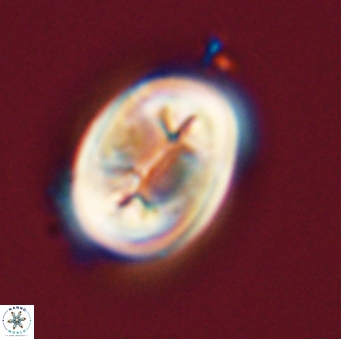 Neocrepidolithus opertus 56856