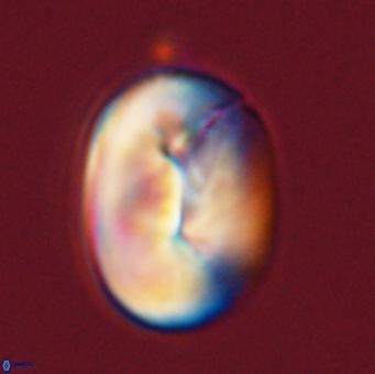 Neocrepidolithus opertus 56857