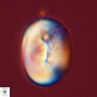 Neocrepidolithus opertus 56857