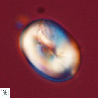 Neocrepidolithus opertus 56860