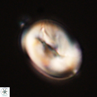 Neocrepidolithus opertus 56861