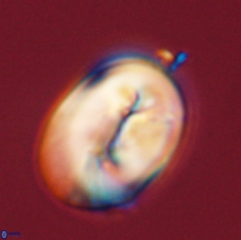 Neocrepidolithus opertus 56863