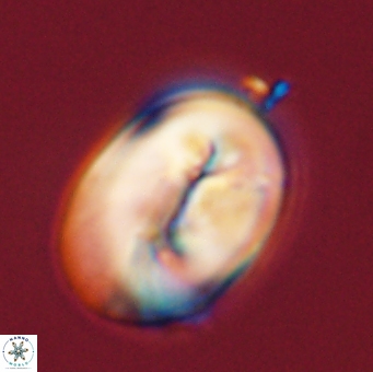 Neocrepidolithus opertus 56863