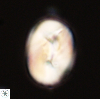 Neocrepidolithus opertus 56867