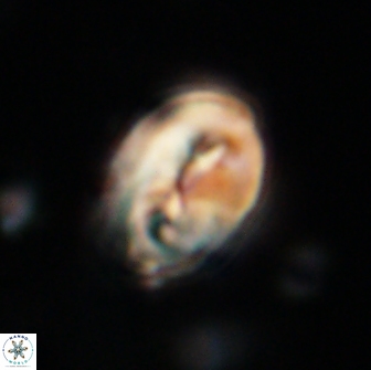 Neocrepidolithus opertus 66410