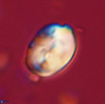Neocrepidolithus opertus 66411