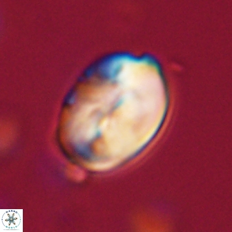 Neocrepidolithus opertus 66411