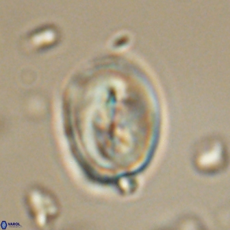 Neocrepidolithus opertus 66412