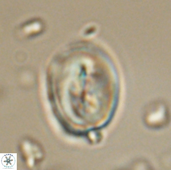 Neocrepidolithus opertus 66412