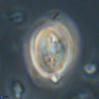 Neocrepidolithus opertus 66413