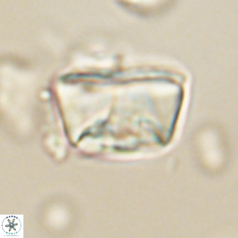 Neocrepidolithus opertus 66417