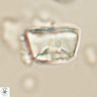 Neocrepidolithus opertus 66418