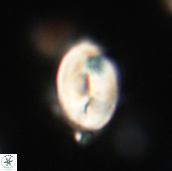 Neocrepidolithus opertus 66431